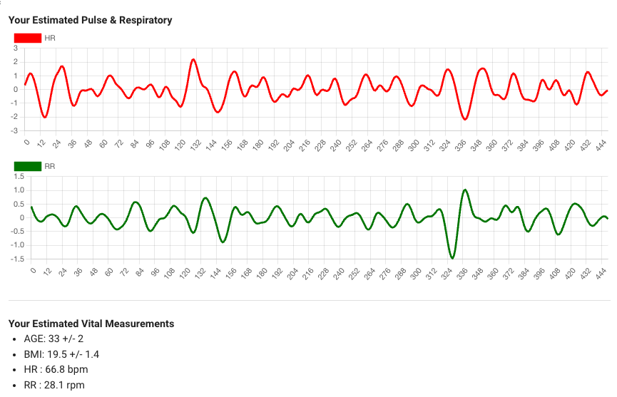 screenshot of vital sign prediction demo